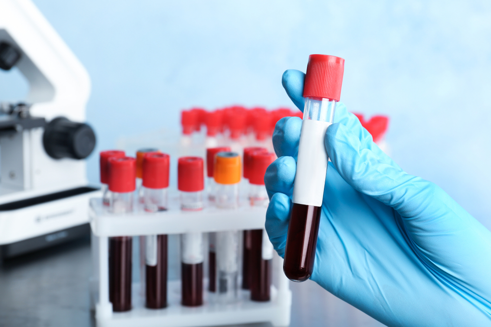 Allergy Testing 101: Which is More Accurate?